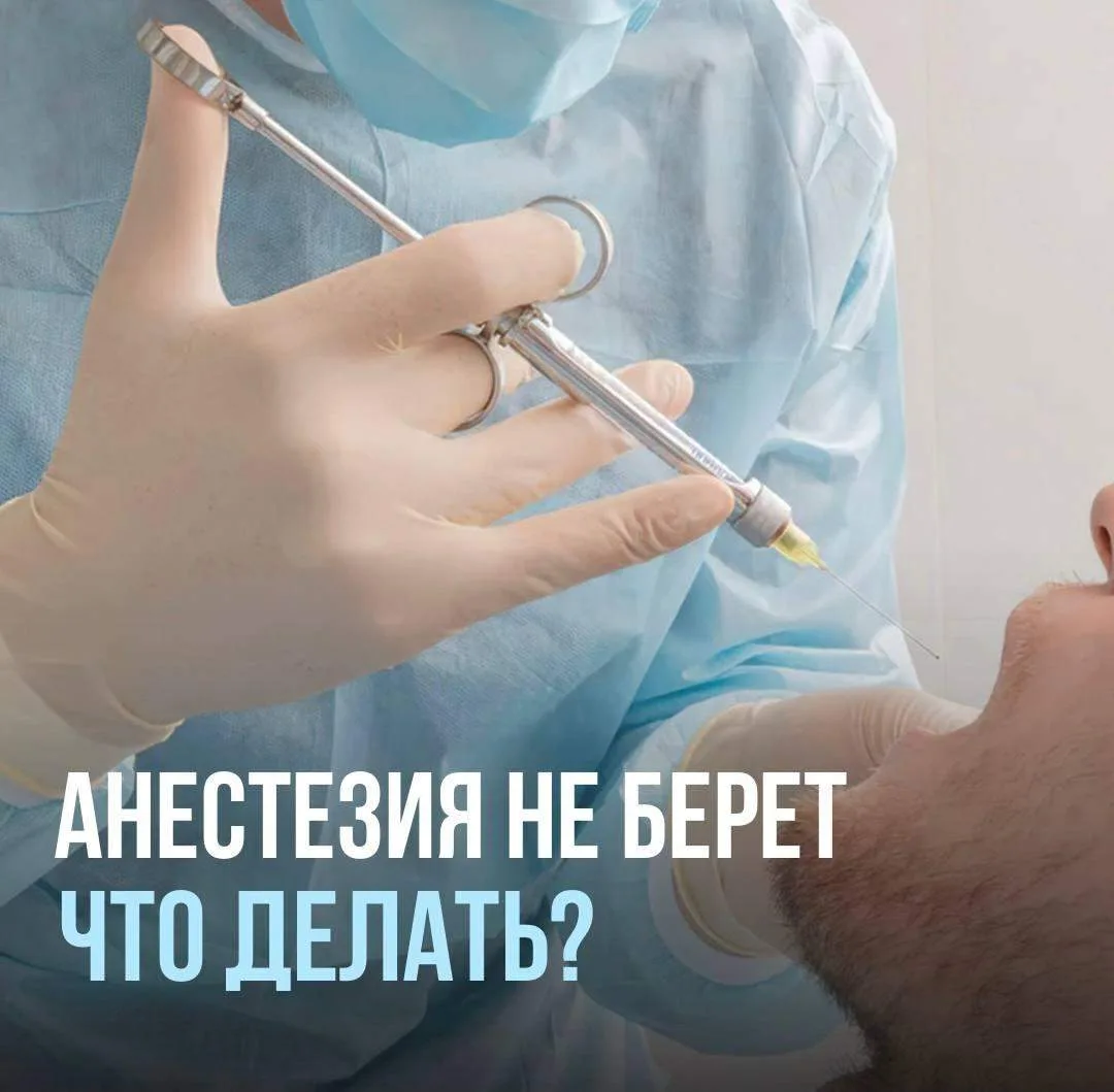 Анестезия сработала, но пациент чувствует боль. Что сделаете вы❓
