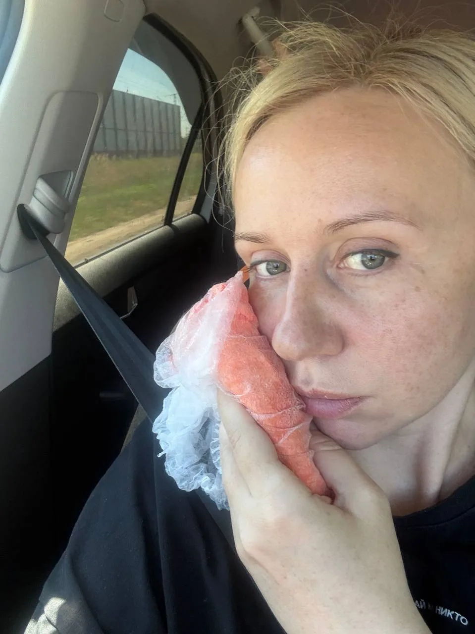 Ну что , из жести - мне удалили зуб! Мой шок - шок!
Треснул корень зуба, все пошло по неправильному 