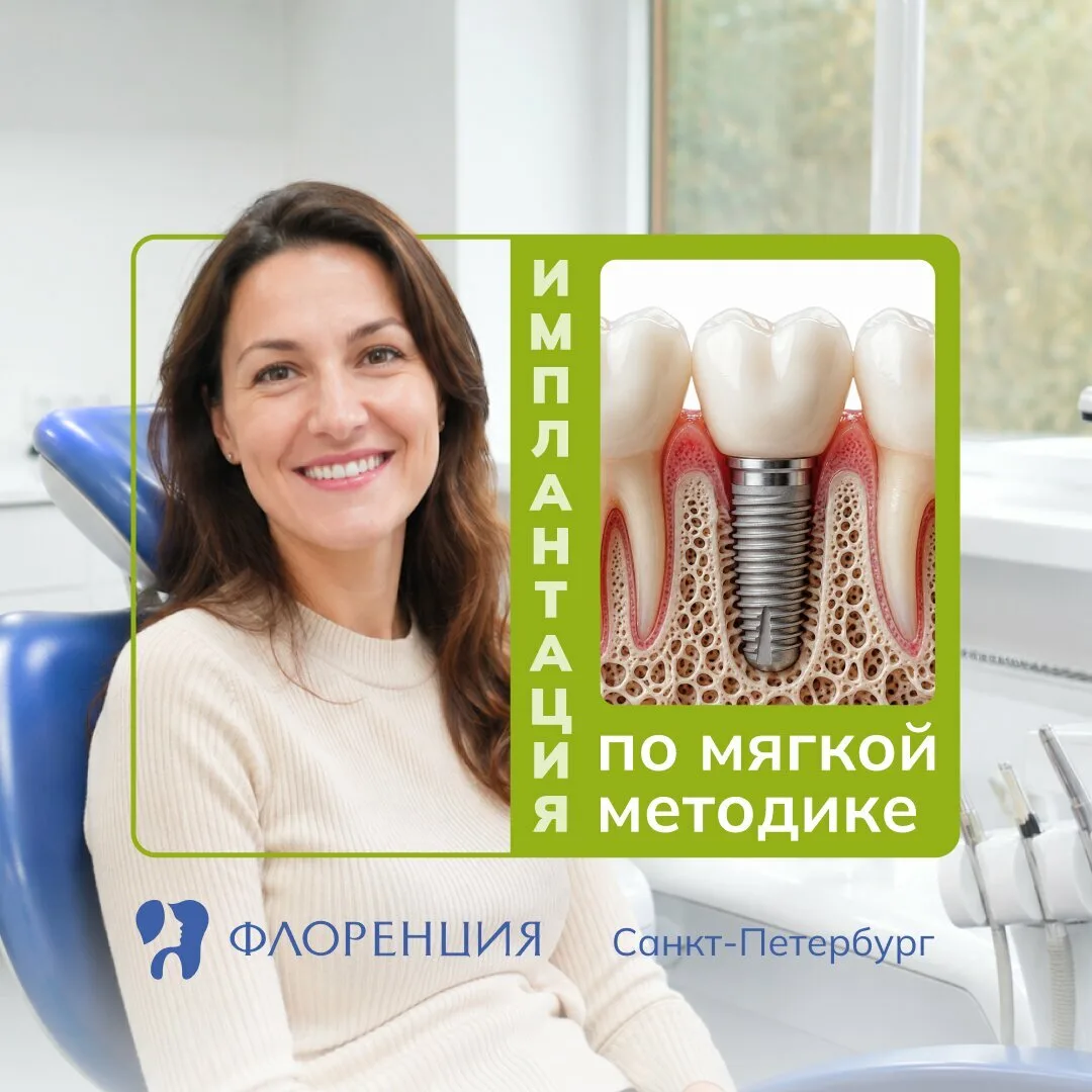 Имплантация зубов по мягкой методике в Санкт-Петербурге