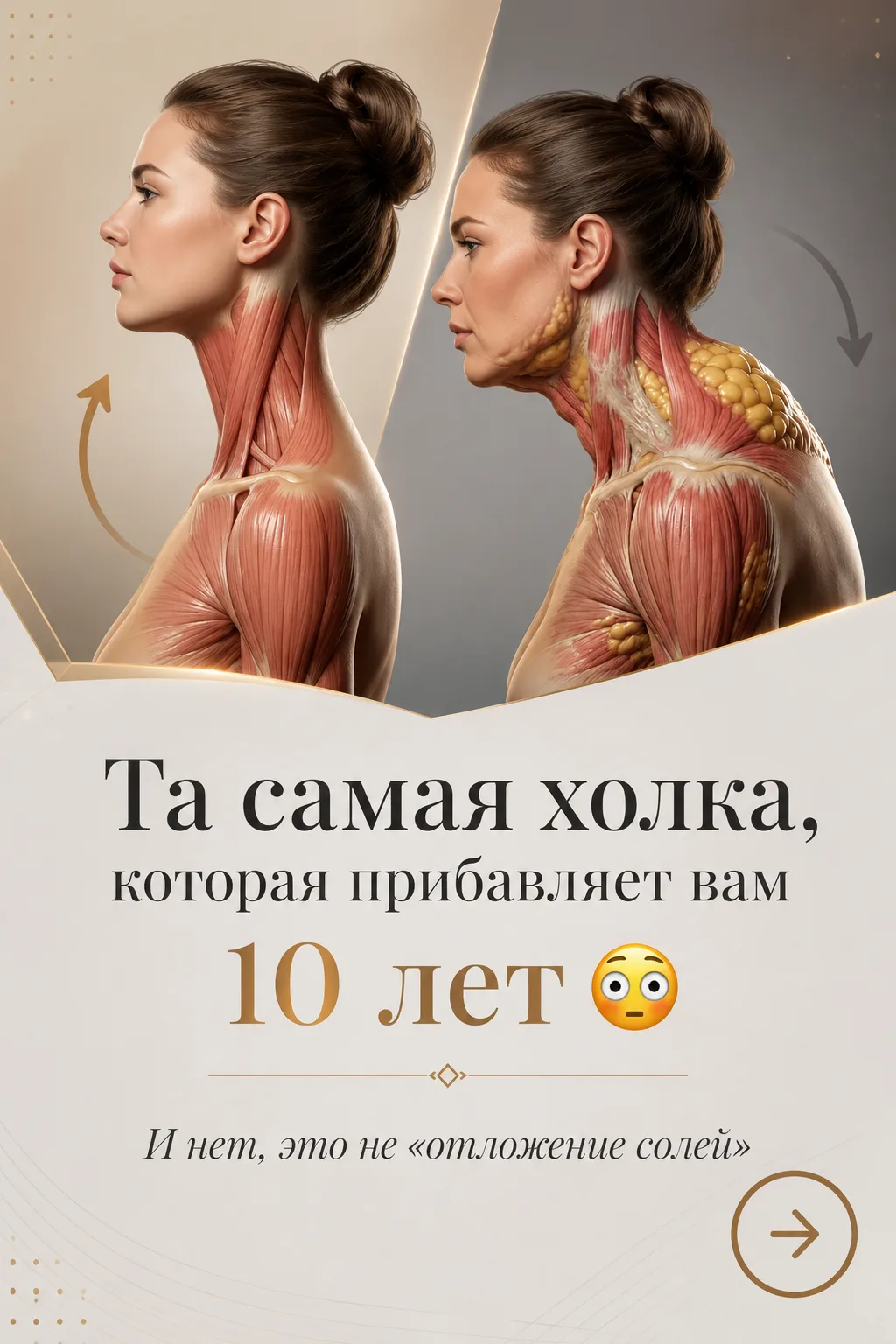 Та самая холка, которая прибавляет вам 10 лет 😳

Дорогие, посмотрите на эти карточки. Тот самый вал