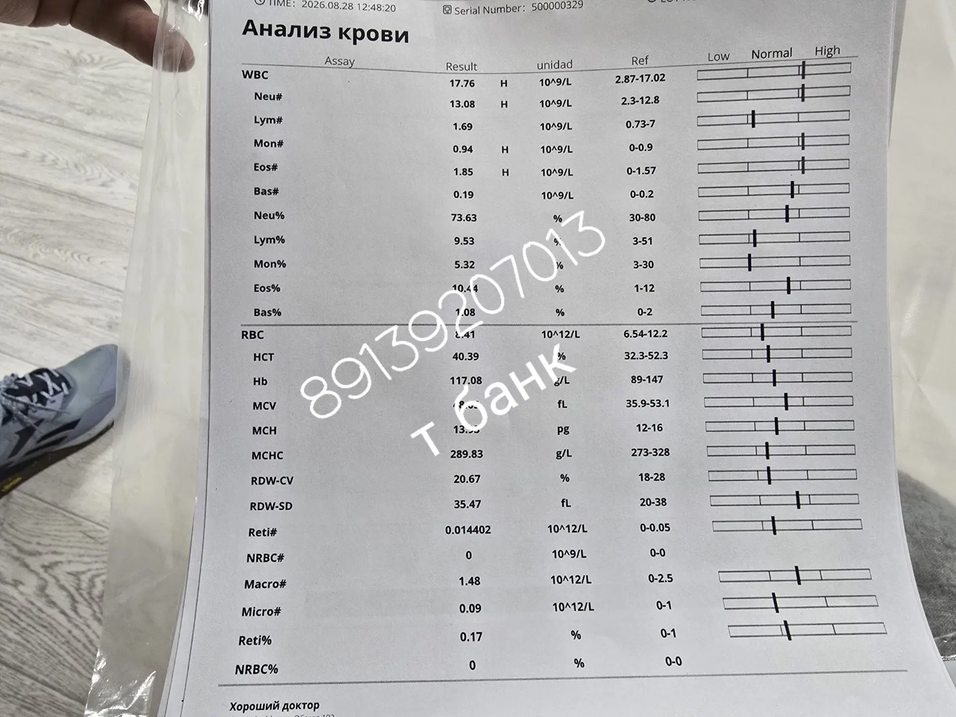 История Черепашки началась примерно три года назад. Её забрали с подвала. Сразу же сдал...