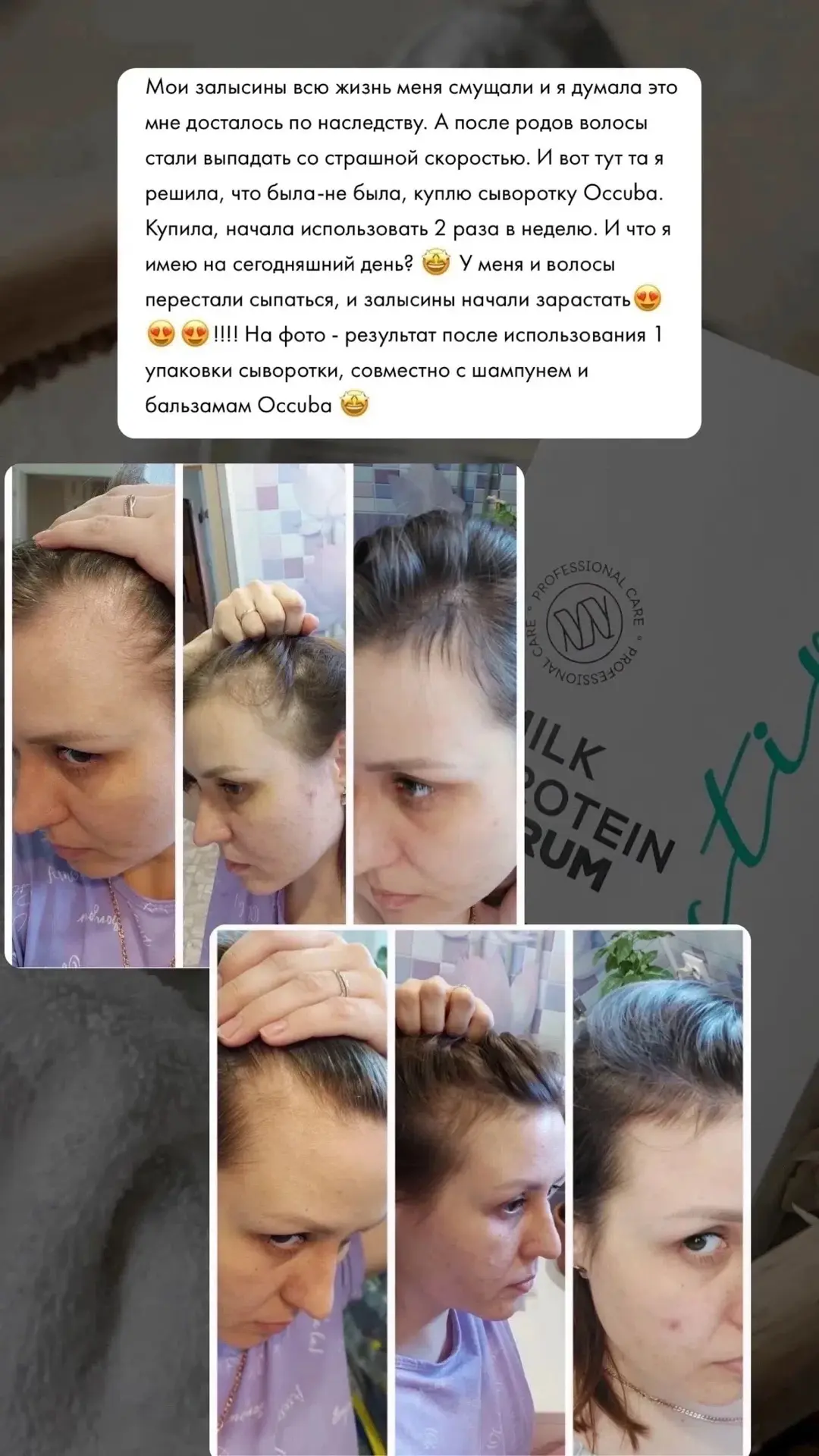 ВЫПАДАЮТ ВОЛОСЫ❓❓есть решение❗❗📌