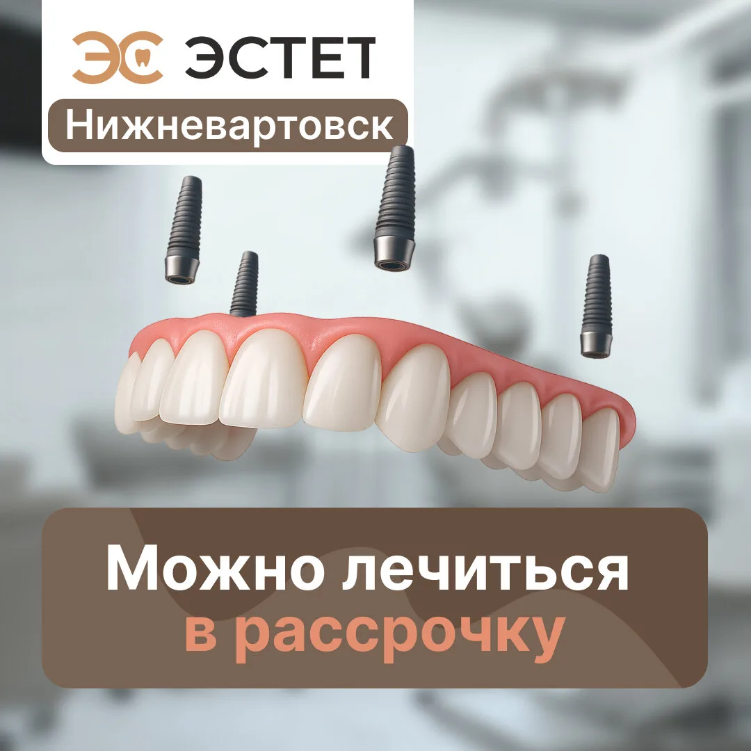 Все зубы сразу на имплантах в Нижневартовске. «Эстет»  Восстановите всю челюсть на 4 имплантах в циф
