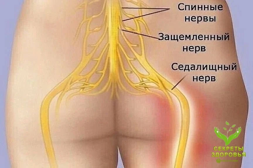 Как разблокировать седалищный нерв! ⠀ Упражнения для растяжки могут оказать большую помощь, так как