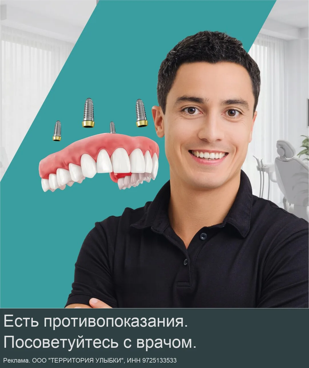 Восстановите все зубы сразу на 4х имплантах в Москве!