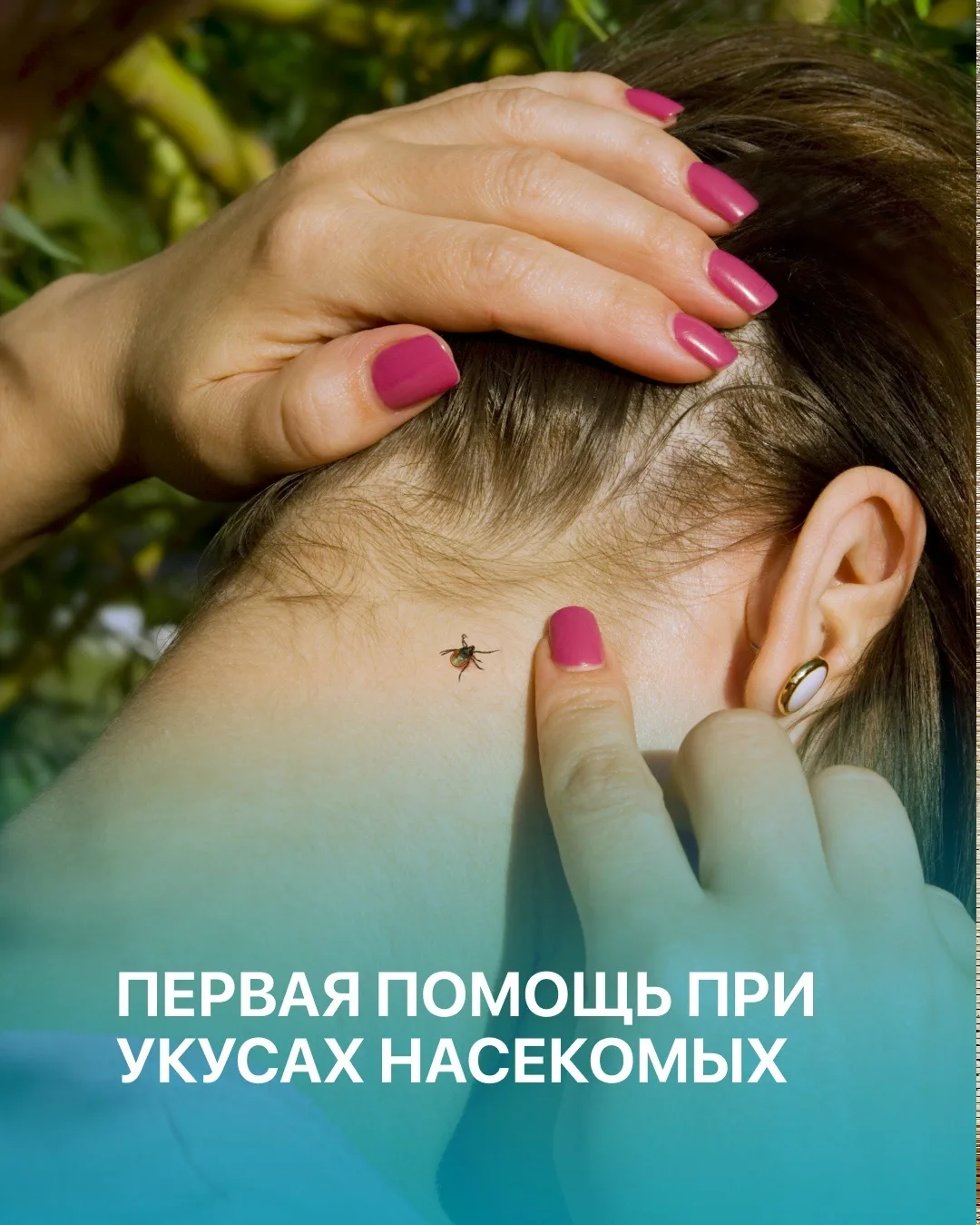 Выезжаете на природу? Вот краткая инструкция, что делать при укусах.