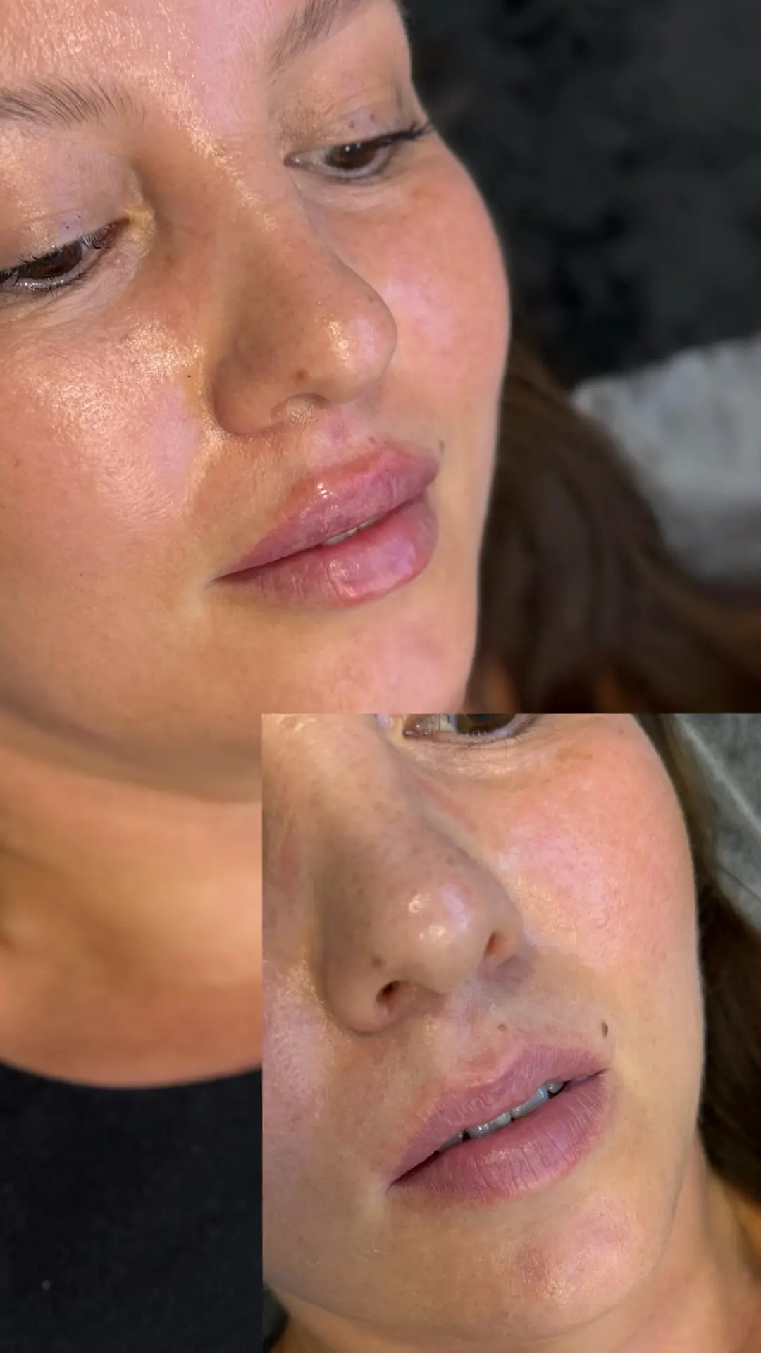 Губы со сложной формой «Чайка » 👄 до /после в 2 этапа .