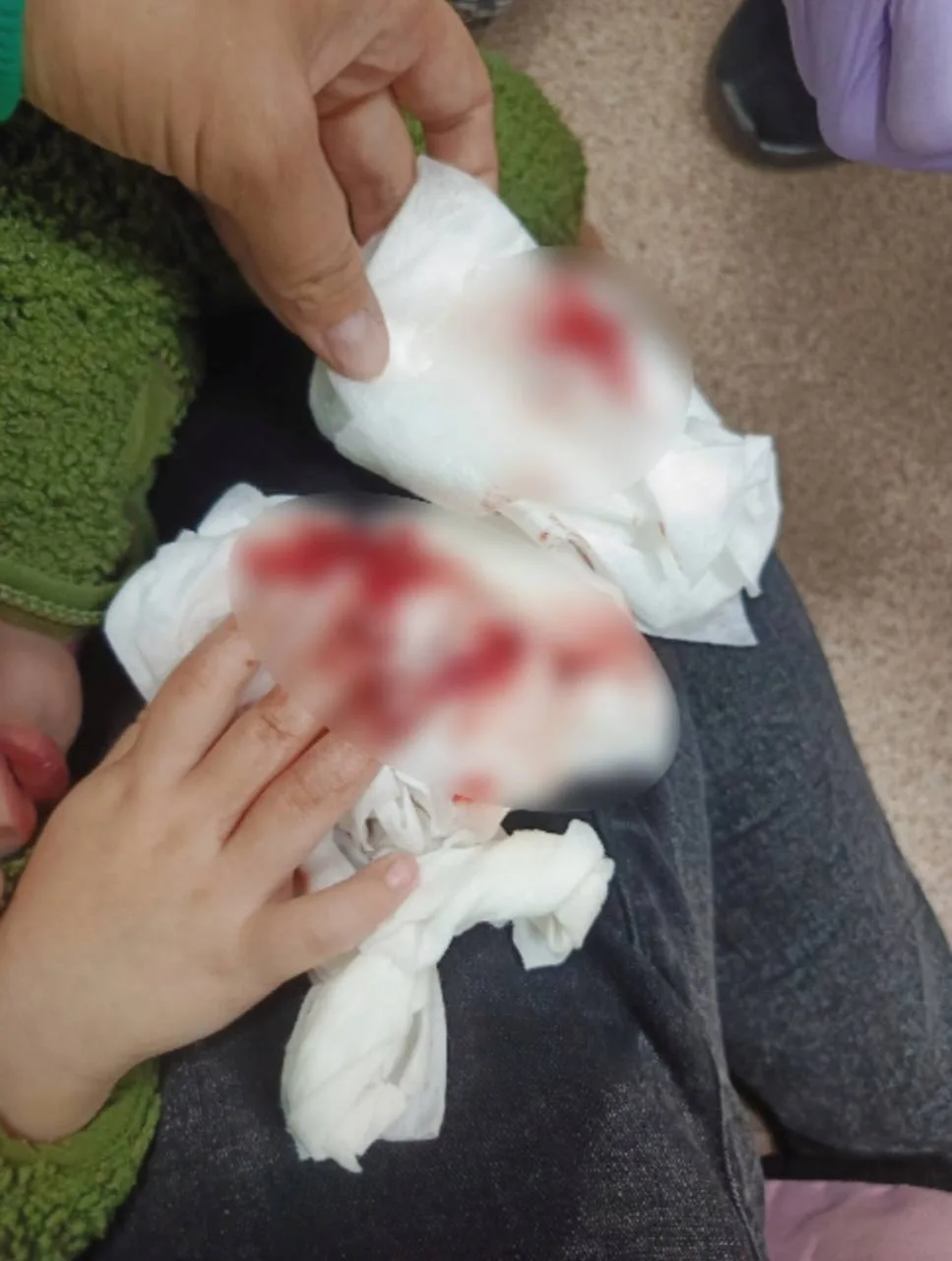 😱 В тюменском детсаду ребёнку до крови прищемили пальцы