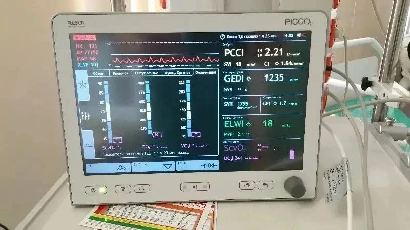 🏥 Реанимация в Жуковском получила новое медоборудование

В больницу поступил монитор для инвазивног