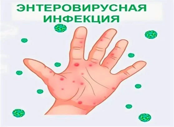 Уважаемые родители!
В связи с ростом заболеваемости энтеровирусной инфекцией, просим вас уделить осо