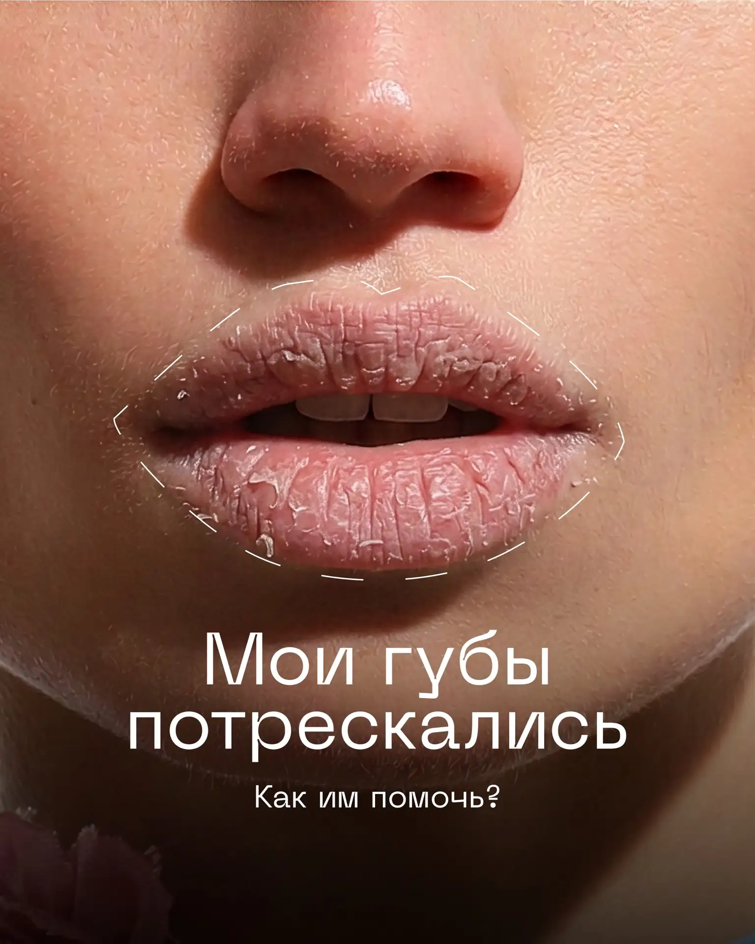 Пусть этим летом сохнут только парни по вам.❤️

А о губах позаботится Mystic Wish.✨