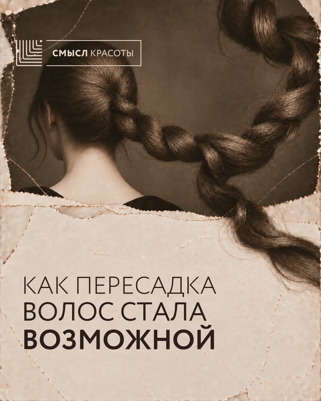 Первые попытки пересадки волос оставили главный вопрос: будут ли они расти на новом месте?