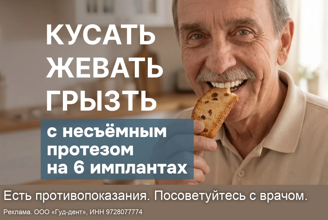 Имплантация зубов в Москве: на 4-х или 6-ти имплантах?
