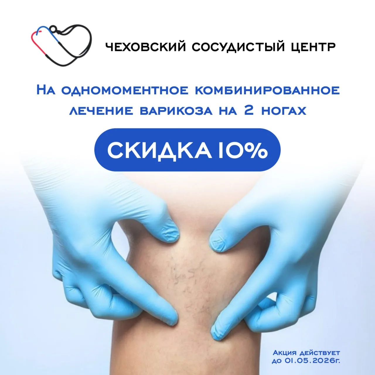 10% СКИДКА на лечение варикоза сразу на двух ногах в Чеховском сосудистом центре!