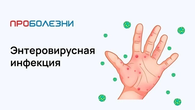 О проведении «горячей линии» по профилактике энтеровирусной инфекции