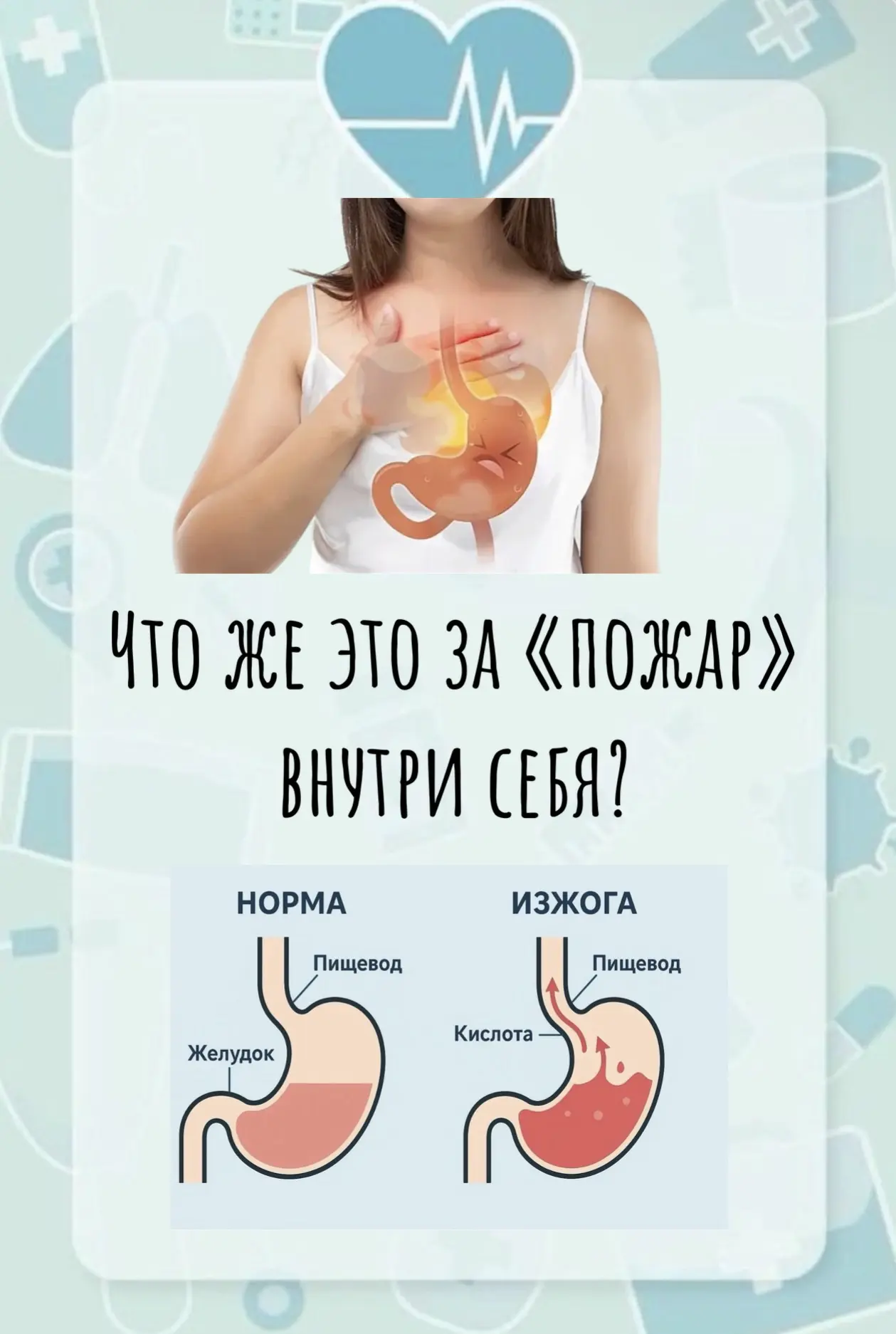 «Доктор, меня совсем изжога замучила!» - очень часто слышу это от своих пациентов