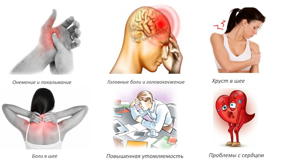 💥Простуда (ОРВИ)  очень часто становится триггером обострения остеохондроза. Врачи дав...