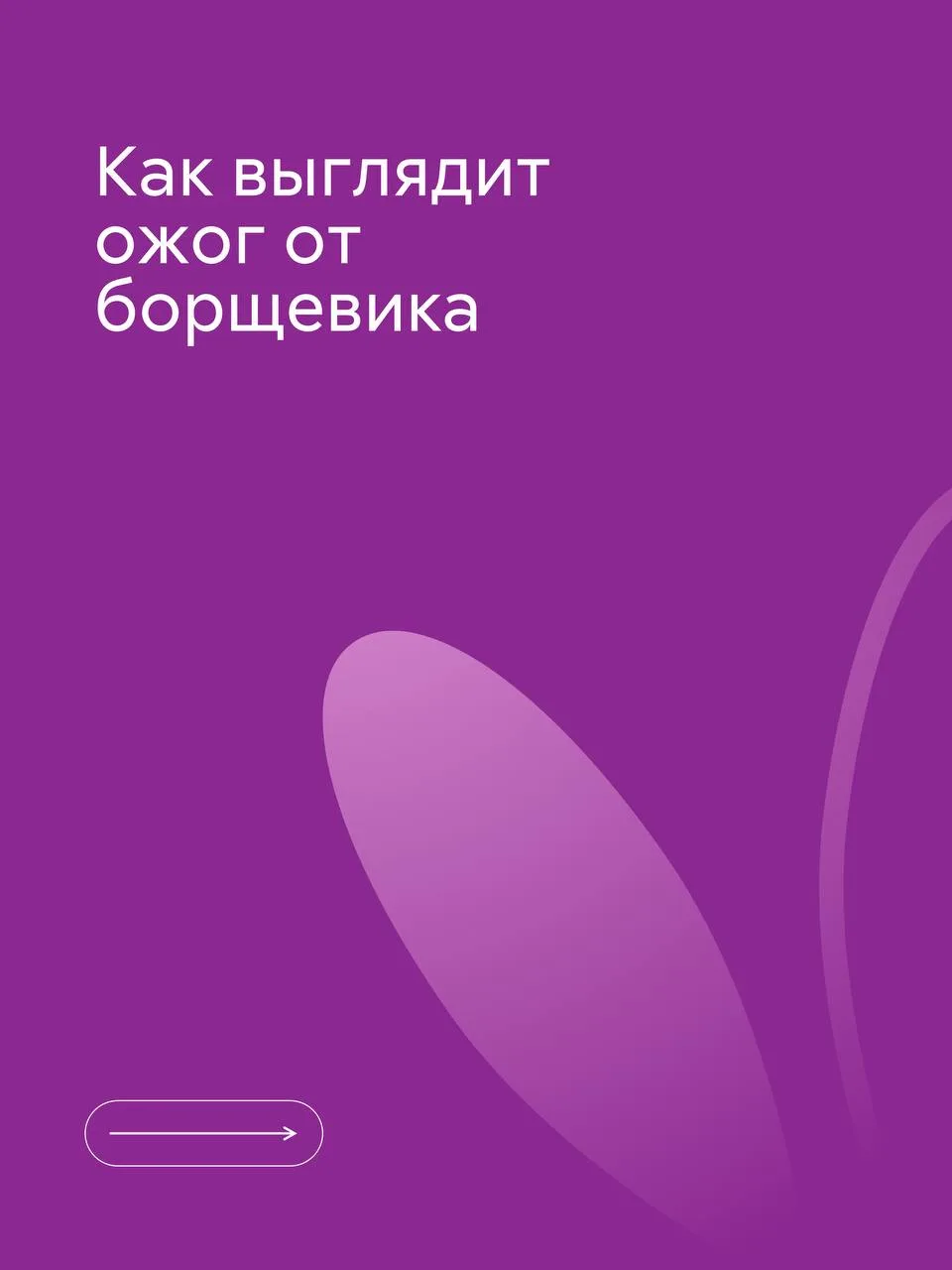 Что делать, если ребенок коснулся борщевика? Делится Анна Редина, педиатр детской клиники Фэнтези:
