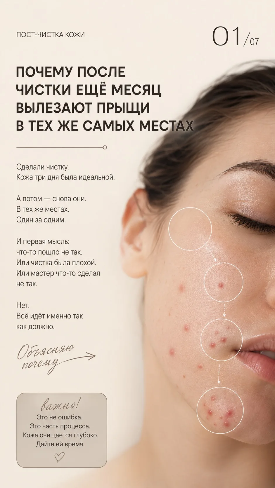 #чисткалица