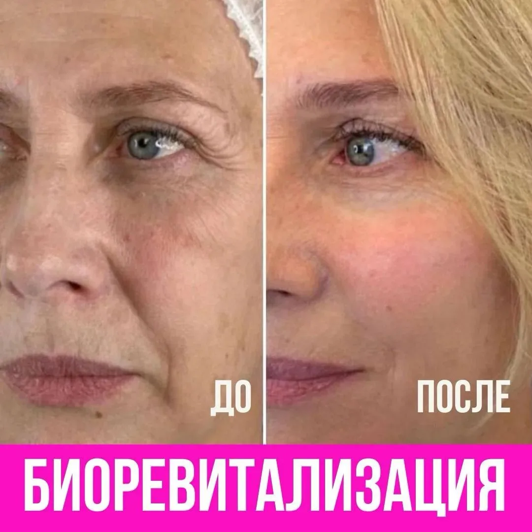 КОСМЕТОЛОГ БУТОВО