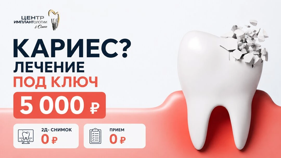 Лечение кариеса "под ключ"- 5000 ₽