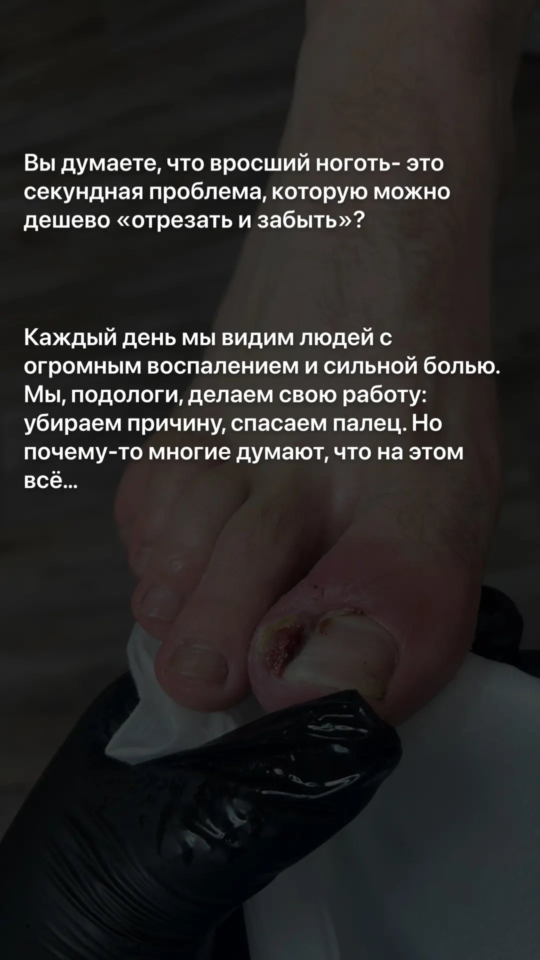 "я забыл" или "я потерял листочек".