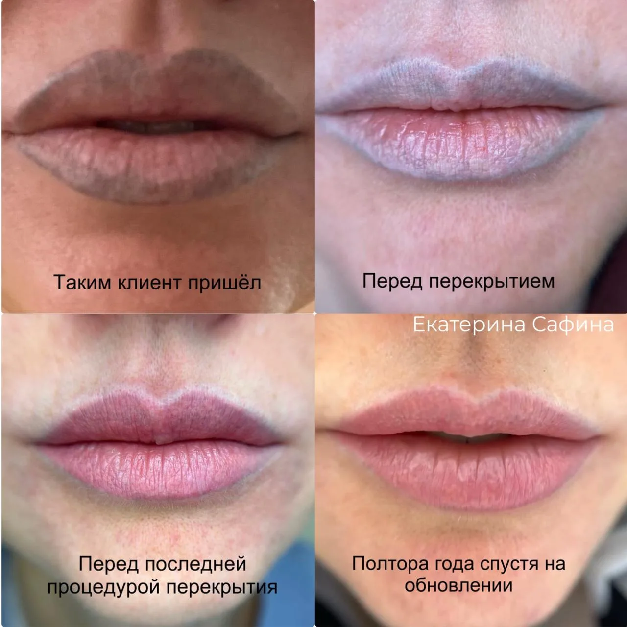 Давайте еще раз поговорим про УДАЛЕНИЯ. Потому что почему-то есть люди, которые утвержд...