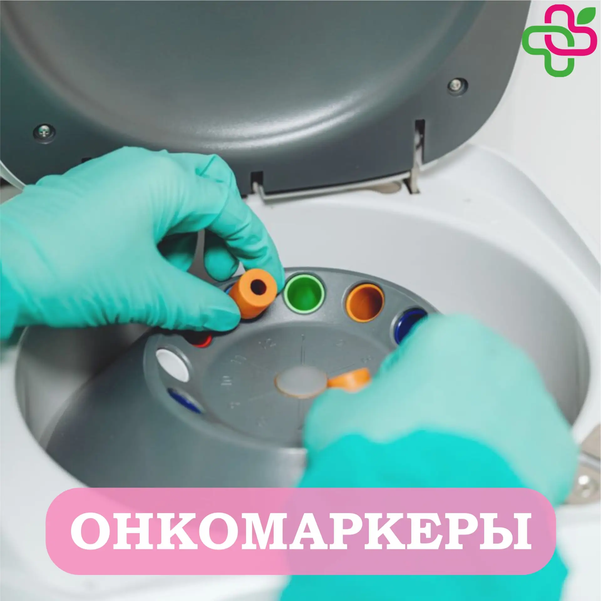 «Сдал кровь на онкомаркеры — здоров» — данное утверждение не всегда верно  🔸 Давайте разберемся, что