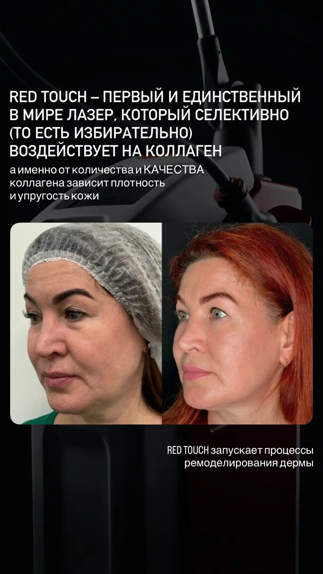 Уникальная новинка в effi! 💥💥💥
