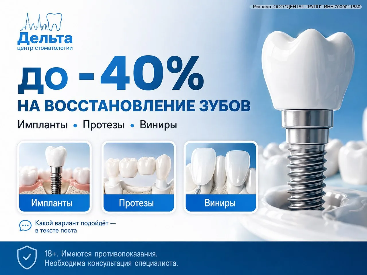 Томск: 4 импланта по цене 3 — акция 3+1