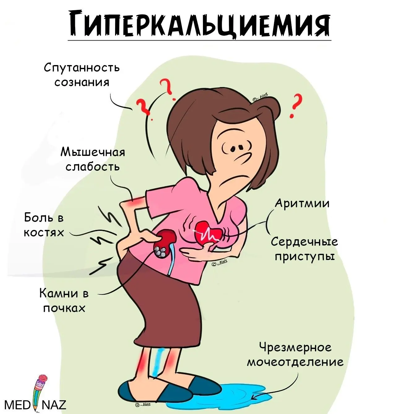 Симптомы гиперкальциемии