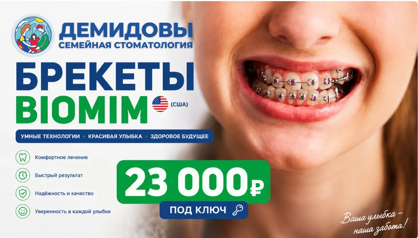 Брекеты Biomim (США) за 23 000 ₽ с установкой