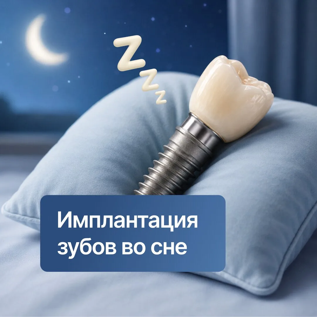 Акция! Зубной имплант с установкой от 23 900 ₽ в Казани!