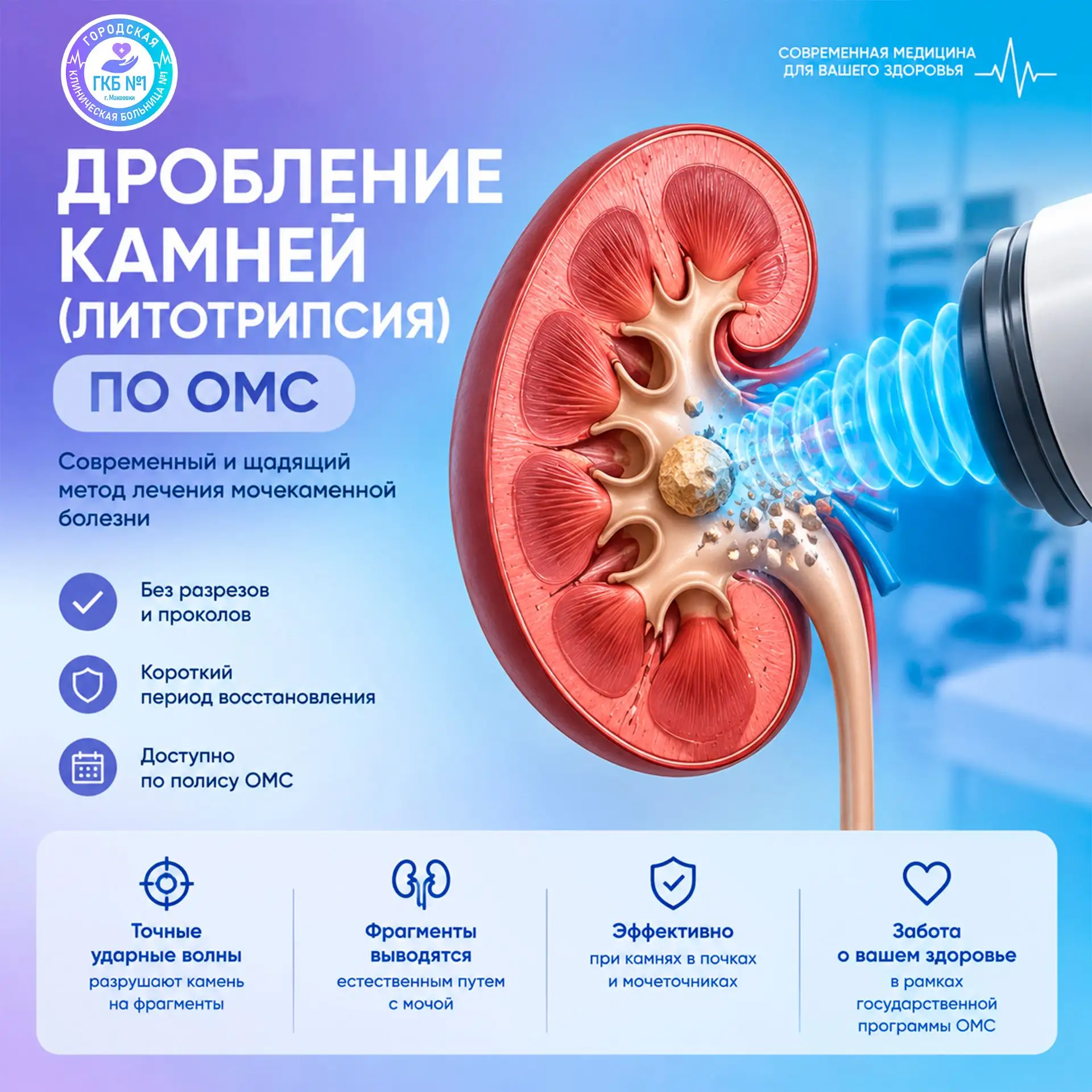 🩺 Дробление камней по ОМС