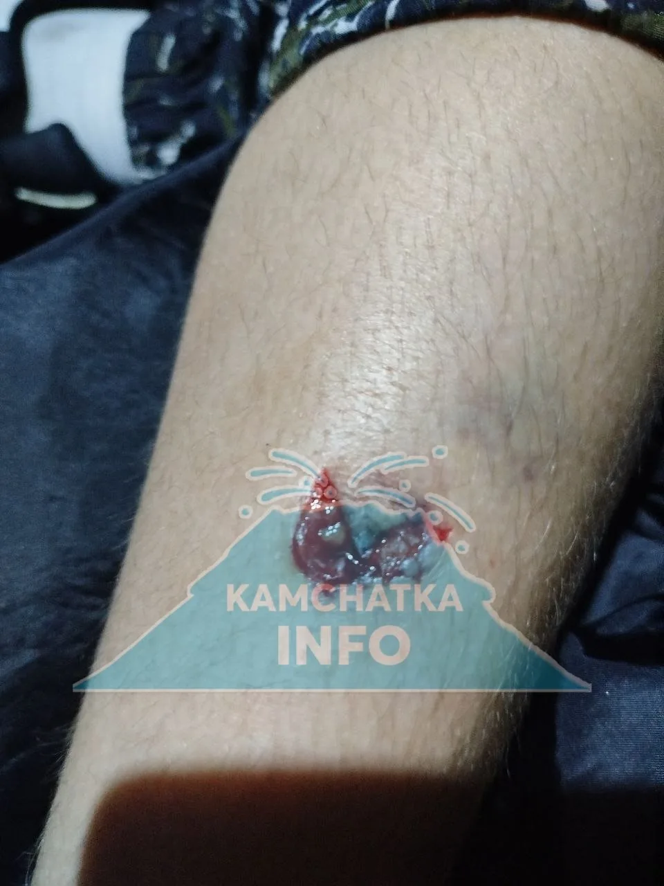 Бастрыкин взял на контроль дело о падении конструкции на детей в Петропавловске