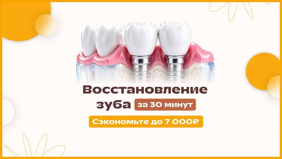 Стесняетесь улыбаться из-за отсутствующего зуба?