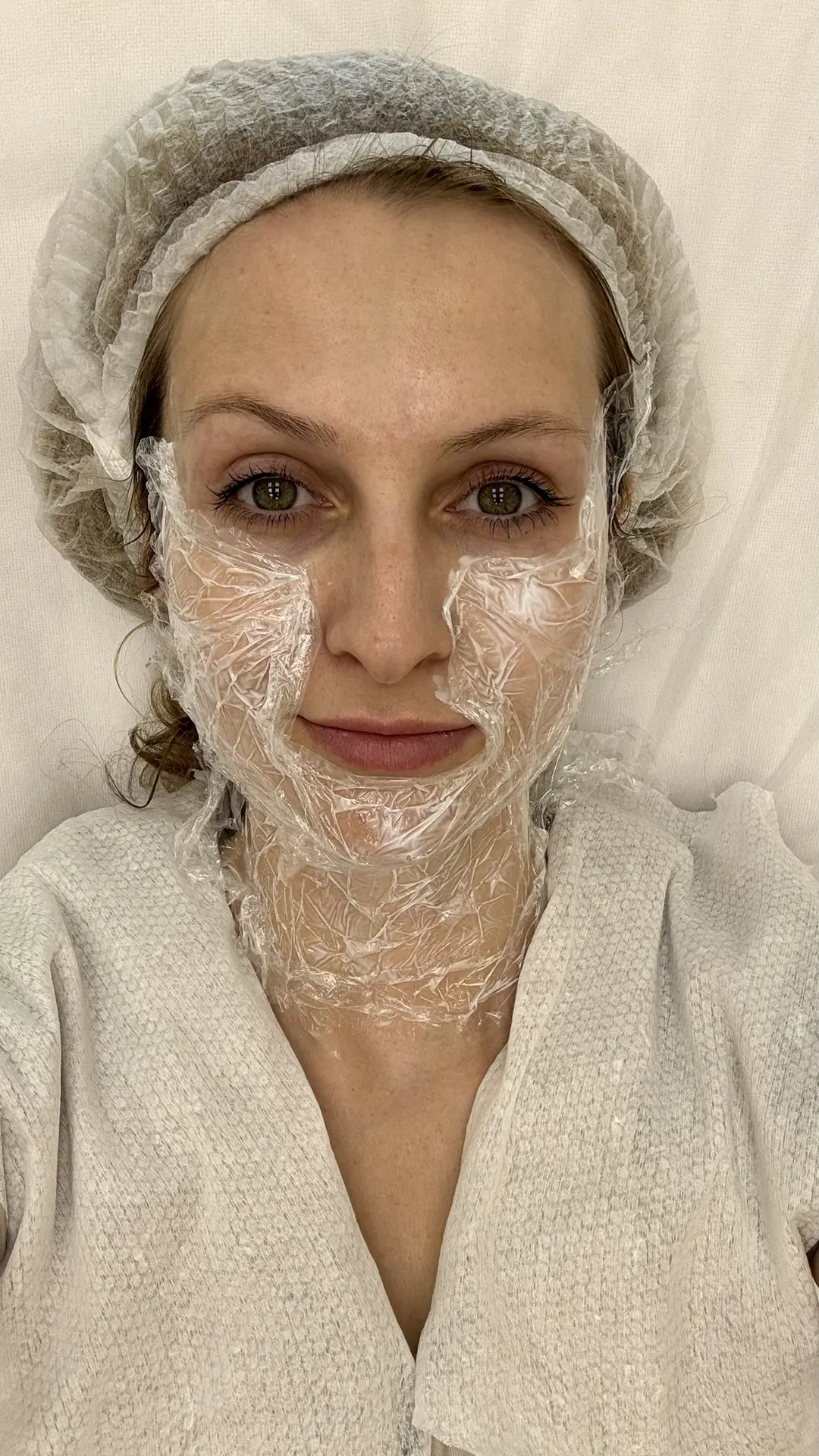 Я на месте.
Делаем Radiesse
