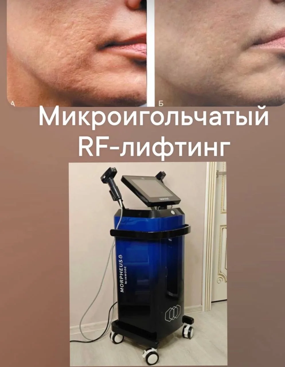Врач - косметолог со стажем более 9 лет, приглашаю на следующие процедуры :