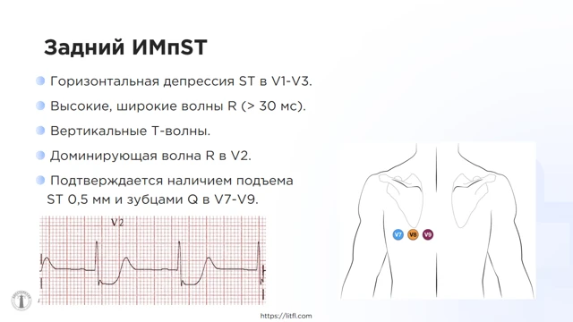 Где Вы? Ждем Вас на вебинаре по боли в грудной клетке

ПОДКЛЮЧИТЬСЯ К ТРАНСЛЯЦИИ