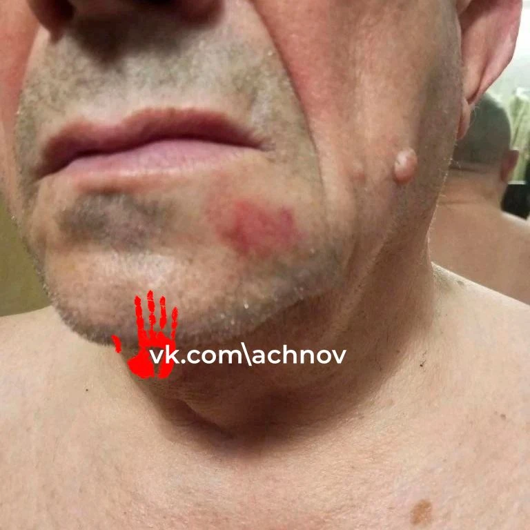 ❗️10 лет страха за свою жизнь 😱. Жители улицы Краснознаменной просят избавить их от со...