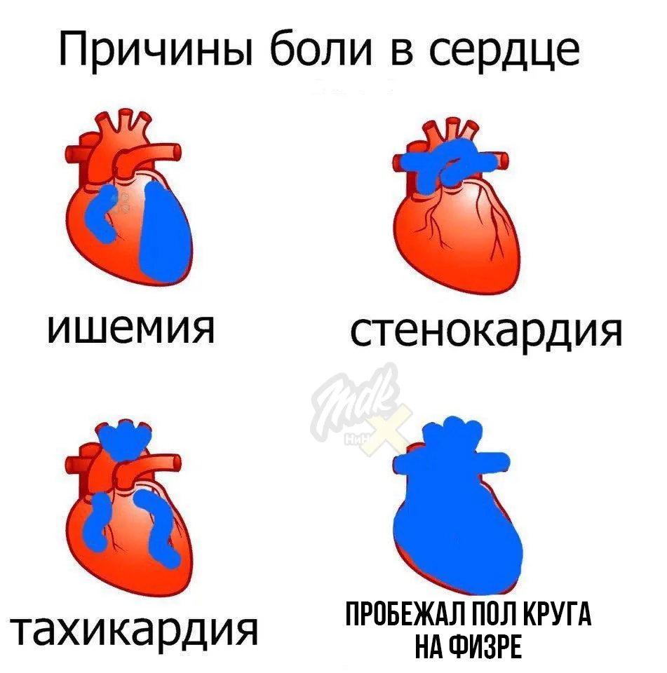 😱В Городце прямо на уроке физкультуры умер мальчик