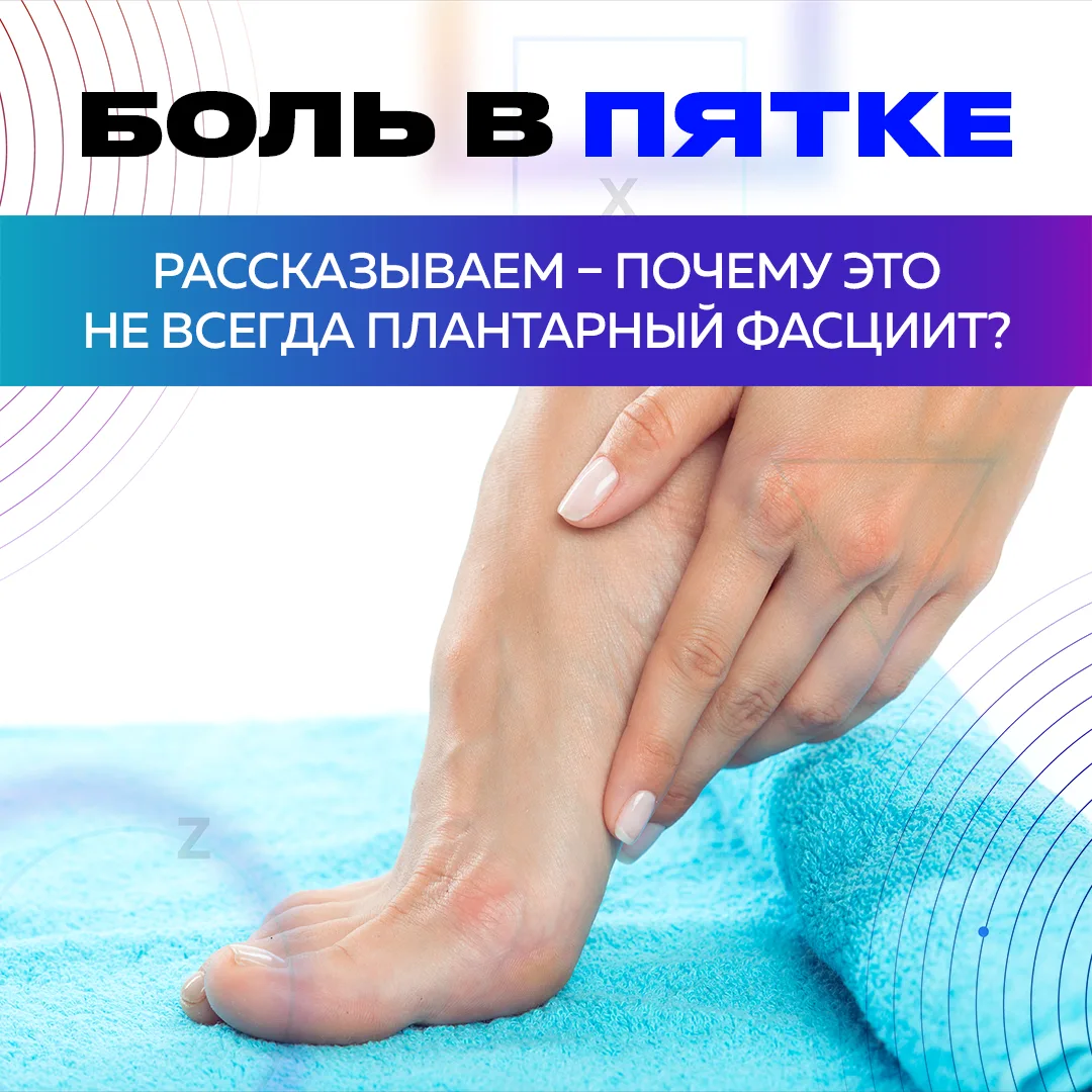 Боль в пятке: почему это не всегда плантарный фасциит? 🦶🔍