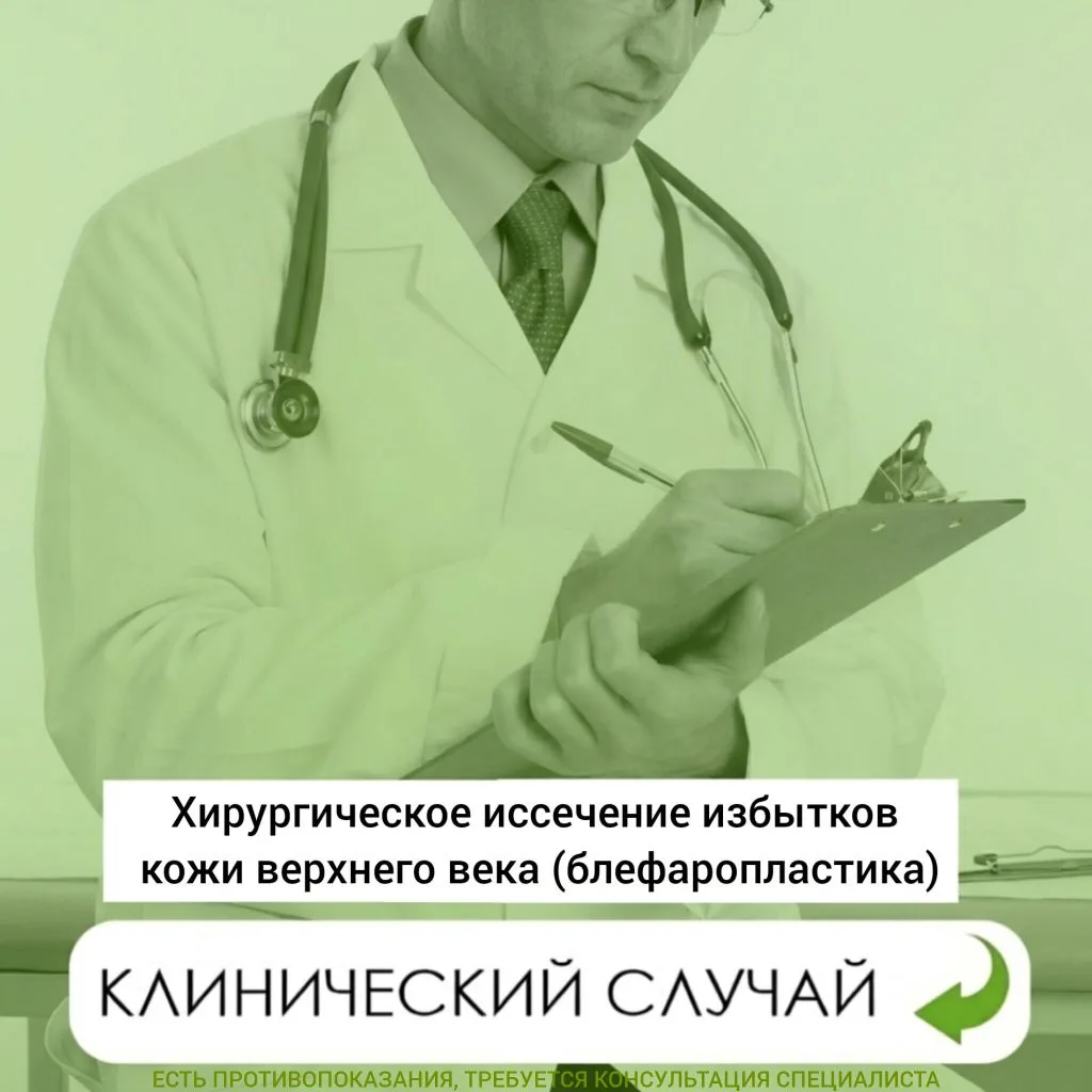 🔴Хирургическое иссечение избытков кожи верхнего века
11 день после операции

Выполнила
Котолуп  Зар