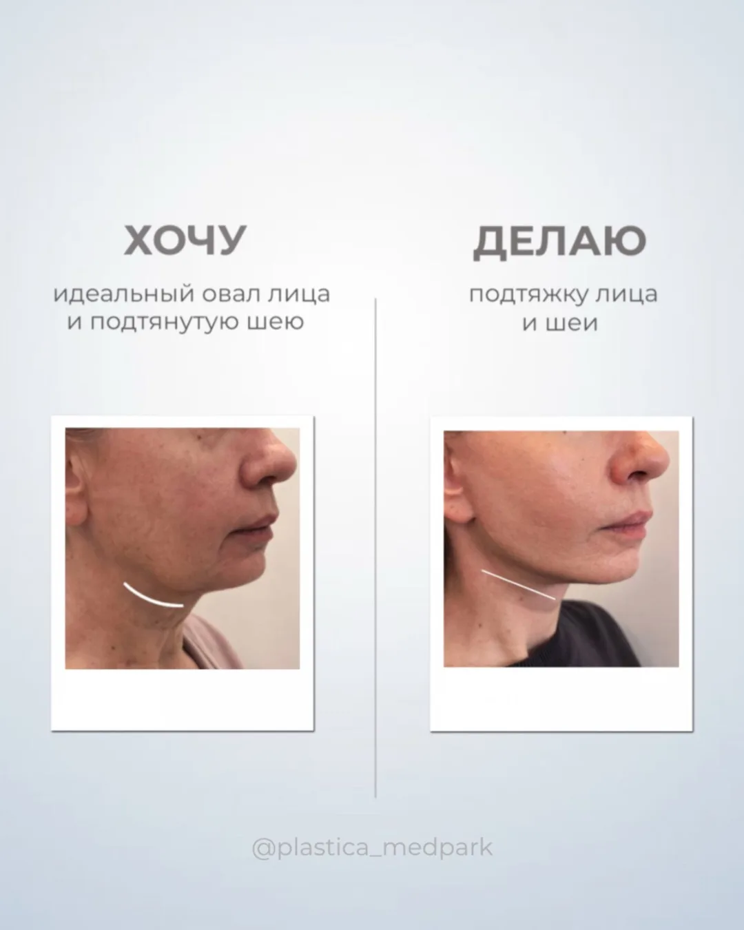 Ваши «хочу» становятся реальными в нашем отделении пластической хирургии 🪡✨