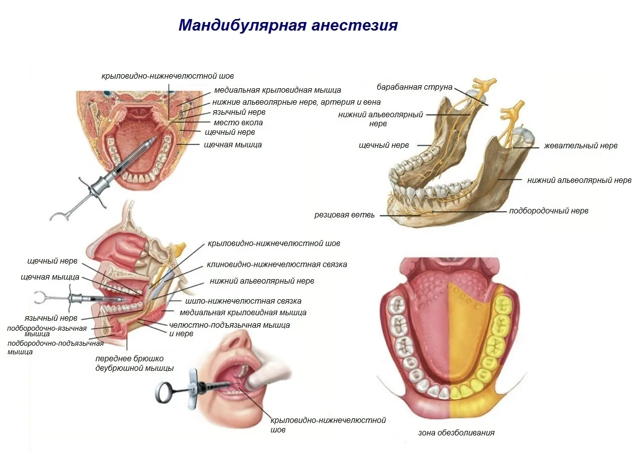✨️Анестезия для стоматологов