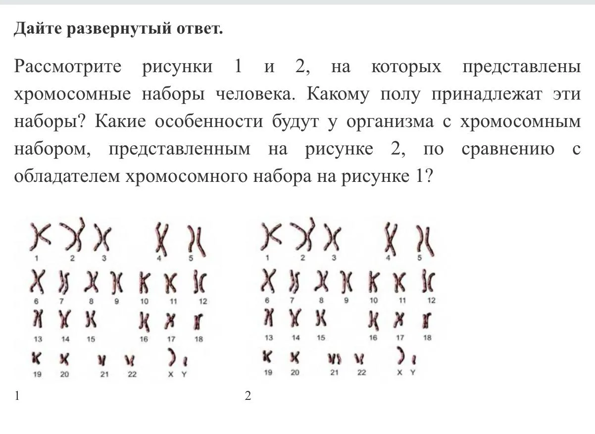❗️ВАЖНО: если вам завтра попадется похожее задание, то во 2 ответе мало просто написать «синдром Дау