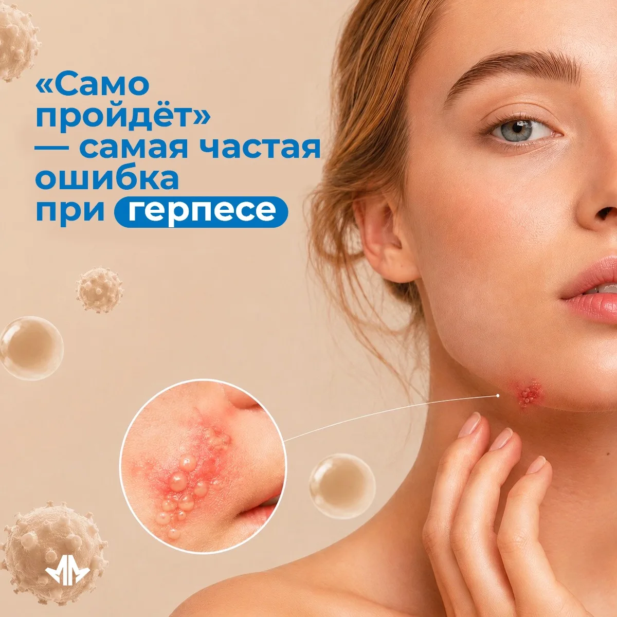 «Само пройдёт» — самая частая ошибка при герпесе 🦠