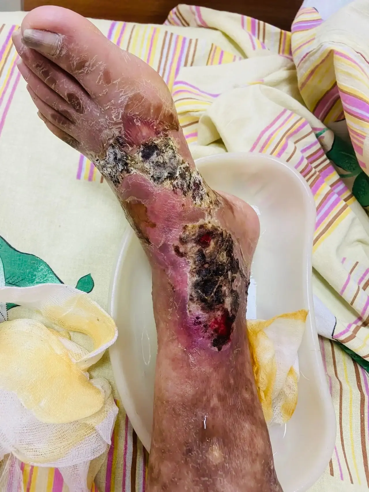 👩‍⚕️ Сайн байна! Я — врач-эндокринолог Дамбинова Лариса Александровна. Хочу поговорить...
