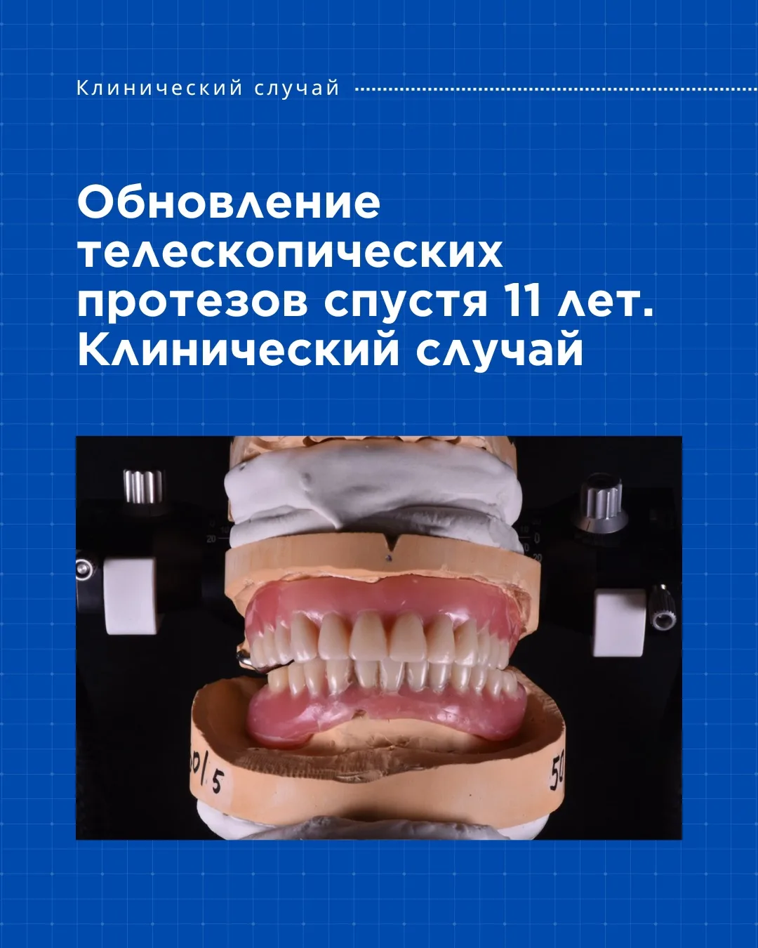 #клиническийслучай