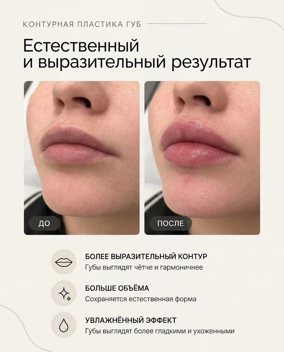 Губы тоже меняются с возрастом.